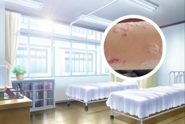 苏州银屑病治疗哪家好：银屑病正确诊断与治疗：如何避免误诊和误治？