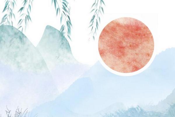 夜晚的折磨！为什么银屑病在晚上会变得更加糟糕？